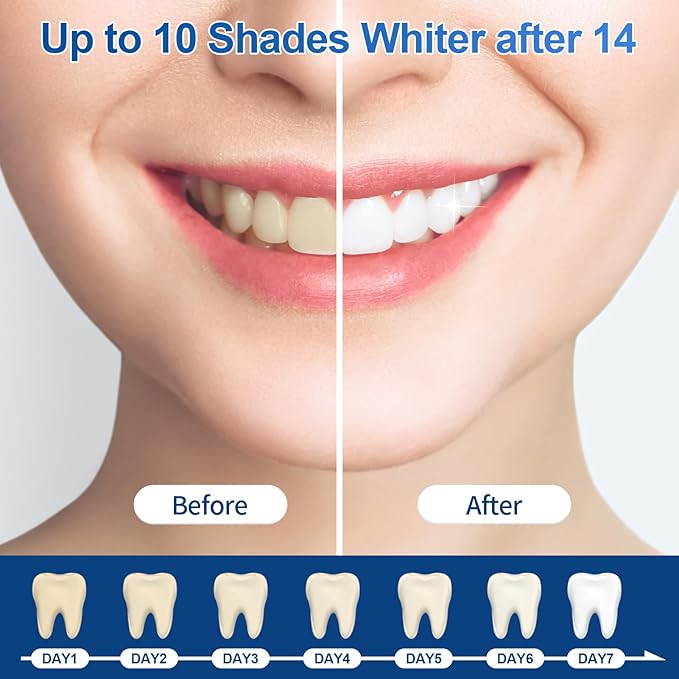 10-Pack Teeth Whitening Gel Refills - Gentle 35% Carbamide Peroxide Formula - Compatible with Teeth whitening Kit,No Sensitive Teeth Whitener